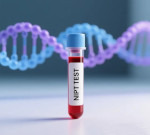 NIFTY (NIPT) ή αμνιοπαρακέντηση;